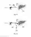 Fig. 09 - Device and method for assisting laparoscopic surgery rule based approach