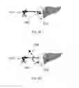 Fig. 11 - Device and method for assisting laparoscopic surgery rule based approach