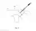 Fig. 25 - Device and method for assisting laparoscopic surgery rule based approach