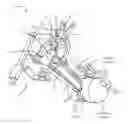Fig. 01 - Surgical access system and related methods