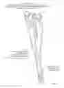 Fig. 10 - Surgical access system and related methods