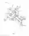 Fig. 13 - Surgical access system and related methods