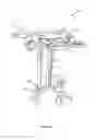 Fig. 15 - Surgical access system and related methods