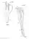 Fig. 04 - Surgical access system and related methods