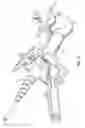 Fig. 12 - Surgical access system and related methods