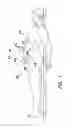 Fig. 02 - Wound Retractor