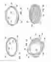 Fig. 07 - Wound Retractor