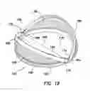 Fig. 09 - Wound Retractor
