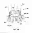 Fig. 14 - Wound Retractor