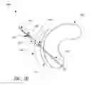 Fig. 04 - Meniscus horn relocation device and method