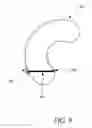 Fig. 12 - Meniscus horn relocation device and method