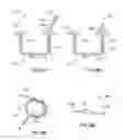 Fig. 11 - Joining devices, kits and methods