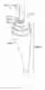 Fig. 01 - ANCHOR-DELIVERY SHEATH TIP