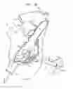 Fig. 03 - ANCHOR-DELIVERY SHEATH TIP