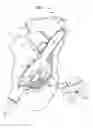 Fig. 04 - ANCHOR-DELIVERY SHEATH TIP