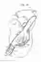 Fig. 05 - ANCHOR-DELIVERY SHEATH TIP