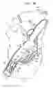 Fig. 09 - ANCHOR-DELIVERY SHEATH TIP