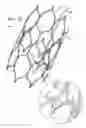 Fig. 10 - ANCHOR-DELIVERY SHEATH TIP