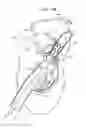 Fig. 12 - ANCHOR-DELIVERY SHEATH TIP