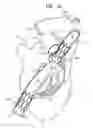 Fig. 13 - ANCHOR-DELIVERY SHEATH TIP