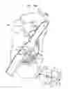 Fig. 14 - ANCHOR-DELIVERY SHEATH TIP