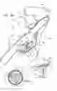 Fig. 15 - ANCHOR-DELIVERY SHEATH TIP