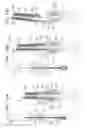 Fig. 24 - ANCHOR-DELIVERY SHEATH TIP
