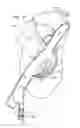 Fig. 31 - ANCHOR-DELIVERY SHEATH TIP