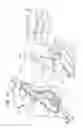 Fig. 37 - ANCHOR-DELIVERY SHEATH TIP