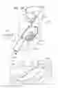 Fig. 38 - ANCHOR-DELIVERY SHEATH TIP