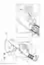 Fig. 40 - ANCHOR-DELIVERY SHEATH TIP