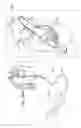 Fig. 48 - ANCHOR-DELIVERY SHEATH TIP