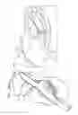 Fig. 50 - ANCHOR-DELIVERY SHEATH TIP