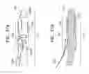 Fig. 55 - ANCHOR-DELIVERY SHEATH TIP