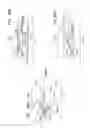 Fig. 56 - ANCHOR-DELIVERY SHEATH TIP
