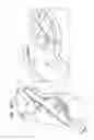 Fig. 60 - ANCHOR-DELIVERY SHEATH TIP