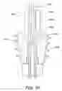 Fig. 11 - Suture anchor