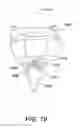Fig. 20 - Suture anchor