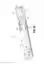 Fig. 18 - Flexible endoscopic stitching devices