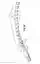 Fig. 22 - Flexible endoscopic stitching devices