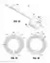 Fig. 30 - Flexible endoscopic stitching devices