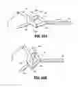 Fig. 46 - Flexible endoscopic stitching devices