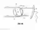 Fig. 47 - Flexible endoscopic stitching devices