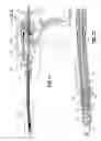 Fig. 51 - Flexible endoscopic stitching devices