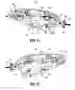 Fig. 53 - Flexible endoscopic stitching devices