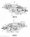 Fig. 56 - Flexible endoscopic stitching devices