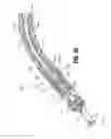 Fig. 62 - Flexible endoscopic stitching devices