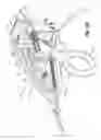 Fig. 71 - Flexible endoscopic stitching devices