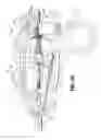 Fig. 75 - Flexible endoscopic stitching devices
