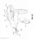 Fig. 77 - Flexible endoscopic stitching devices